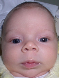 ryan_veryclose_head_face.JPG (84973 bytes)